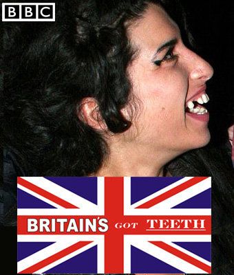 Britain's Got Teeth Problems - Stereotypes have never seemed so fun!
